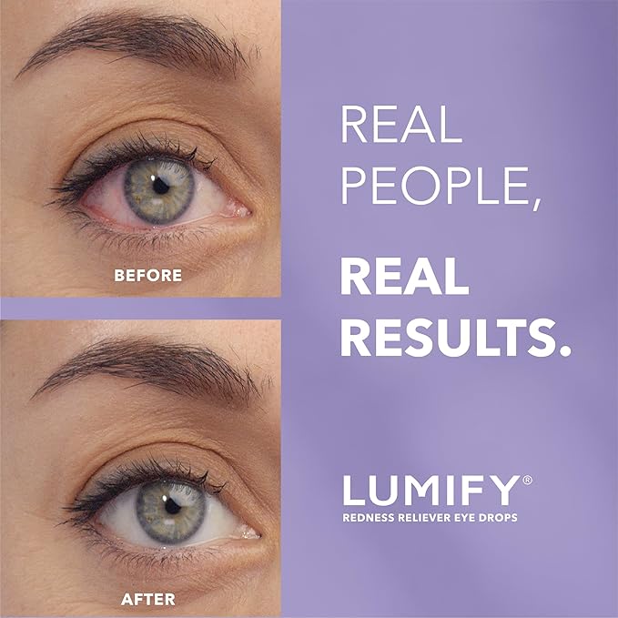 LUMIFY Eye Drops for Red Eyes, Redness Reliever for Brighter Looking Eyes, Works in 1 Minute & Lasts Up to 8 Hours, Eye Drops, 0.17 Fl Oz (5 mL)